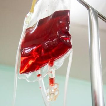 Les groupes sanguins et leur impact potentiel sur la santé