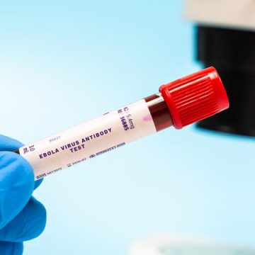 4aaef4a8-ade7-4eb8-9e9b-664a44fd1200 Une nouvelle épidémie d’Ebola déclarée en République démocratique du Congo