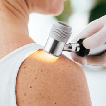 Une nouvelle méthode prometteuse pour détecter les cancers de la peau