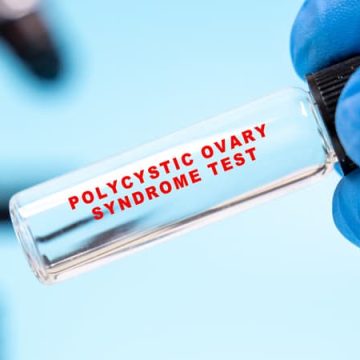 Renommage du Syndrome des Ovaires Polykystiques: Vers plus de Précision et d’Impact