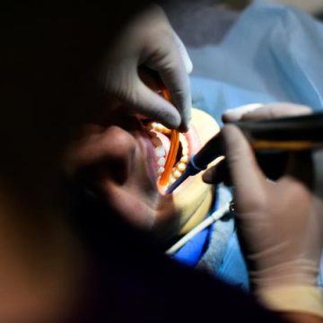 Un dentiste de Marseille condamné pour une fraude massive
