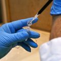 Augmentation des cas de grippe aviaire H9N2 en Chine