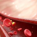 Contrôler le taux de cholestérol pour prévenir les maladies cardiaques
