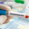 La testostérone chez les femmes : entre mythe et réalité