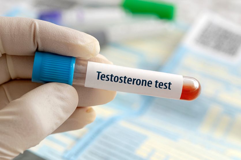 Testosterone hormone test result with blood sample in test tube on doctor hand in medical lab a blue laboratory background. La testostérone chez les femmes : entre mythe et réalité