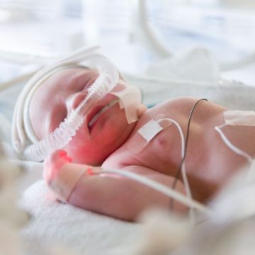 premature newborn baby in incubator Étude sur le devenir des enfants prématurés