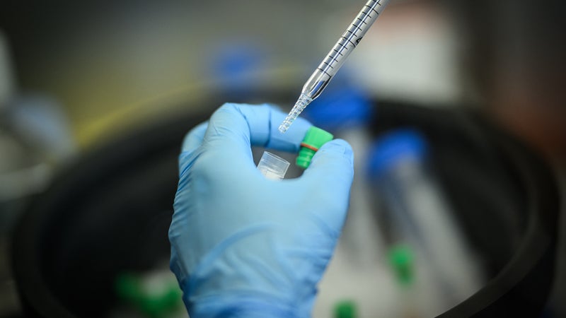 23b369b5-d0ae-48b9-a6b4-5bedb280e2fb Les avancées des vaccins anti-cancer : promesses et défis