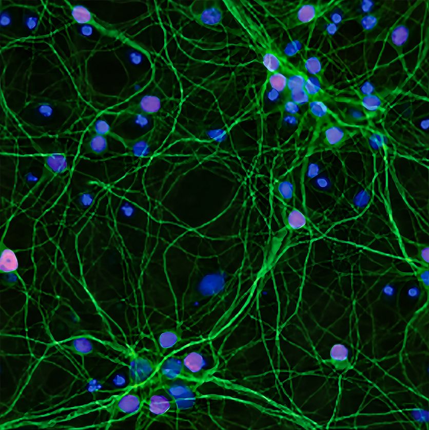 Microscopic image of neurons Les avancées prometteuses du traitement de la maladie de Charcot