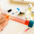 Les infections et leur rôle dans le développement du cancer