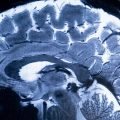 La découverte révolutionnaire du cerveau à l&rsquo;université de Stanford