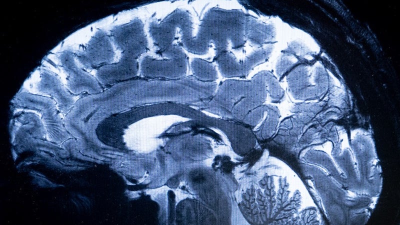 c4bc335b-cae4-44a4-9934-be76ca2db0dc La découverte révolutionnaire du cerveau à l’université de Stanford