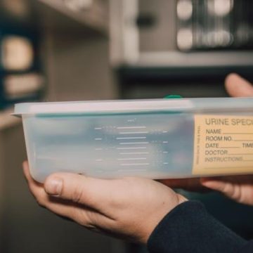 Nouveau test urinaire pour détecter le cancer de la vessie